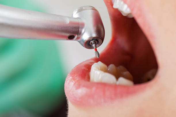 Best Walk-In Emergency Dental Services in Broadlands, VA